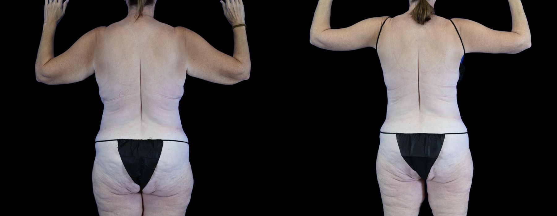 Before photo - Angle 4