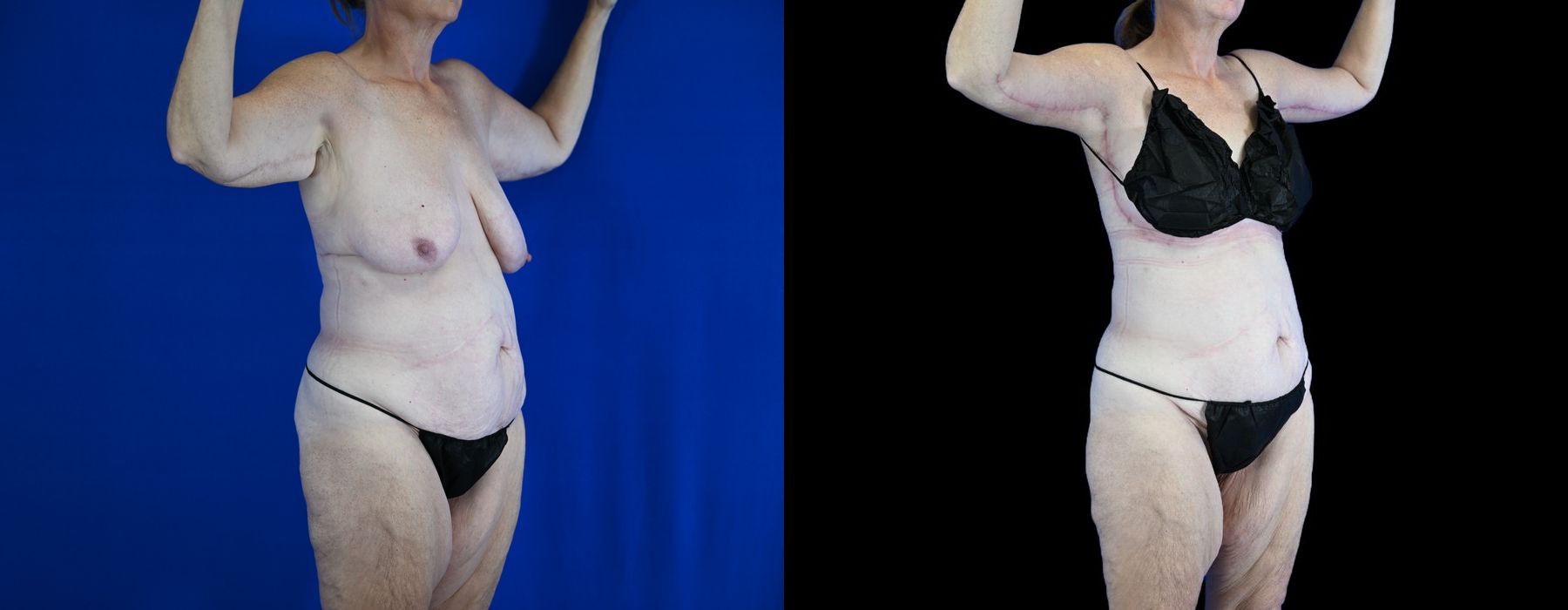 Before photo - Angle 3