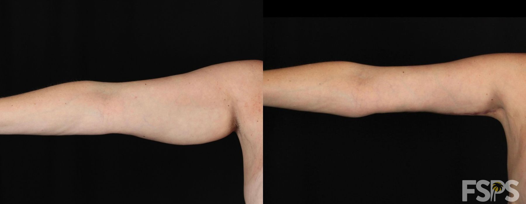 Before photo - Angle 2