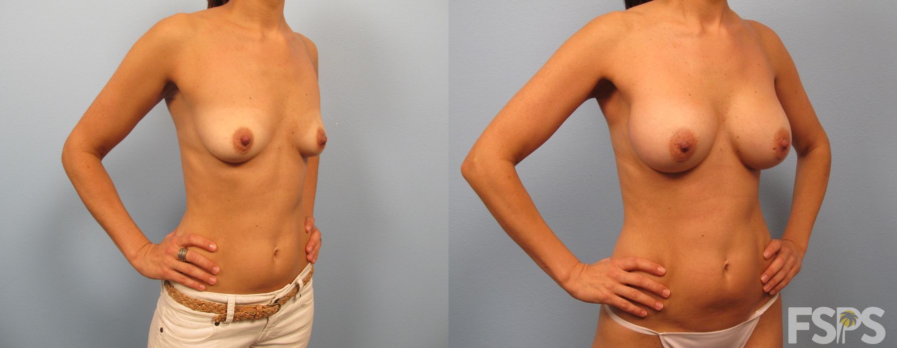 Before photo - Angle 2