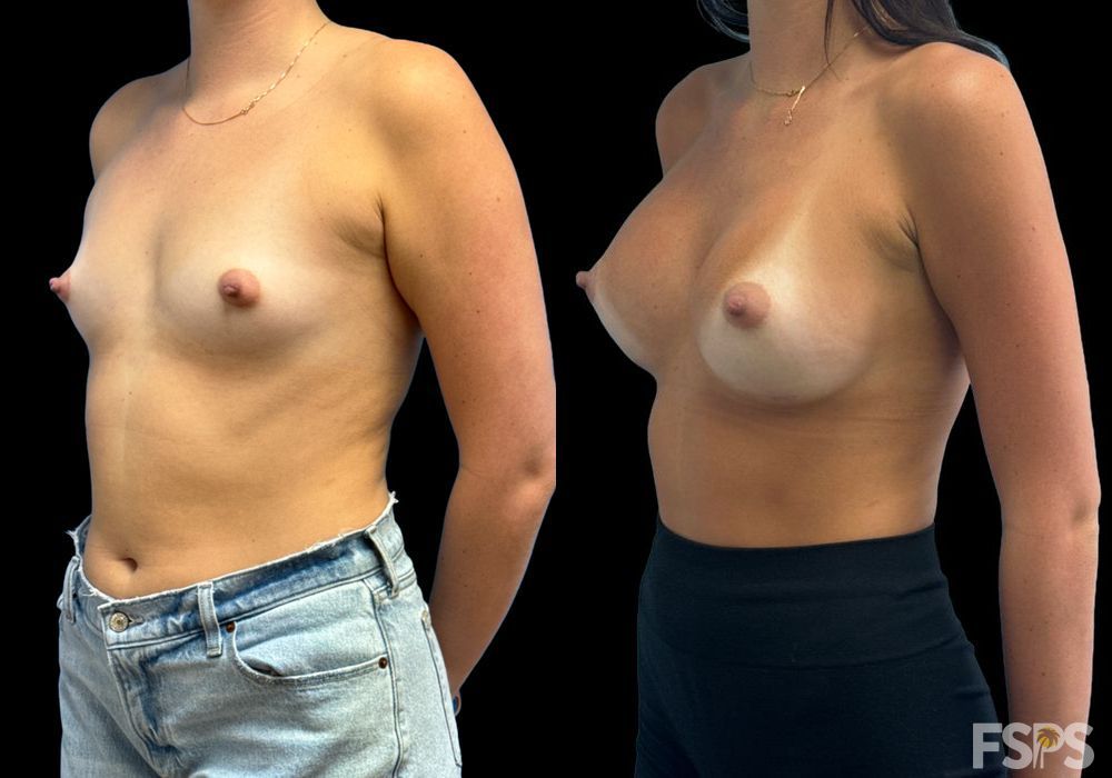 Before photo - Angle 2