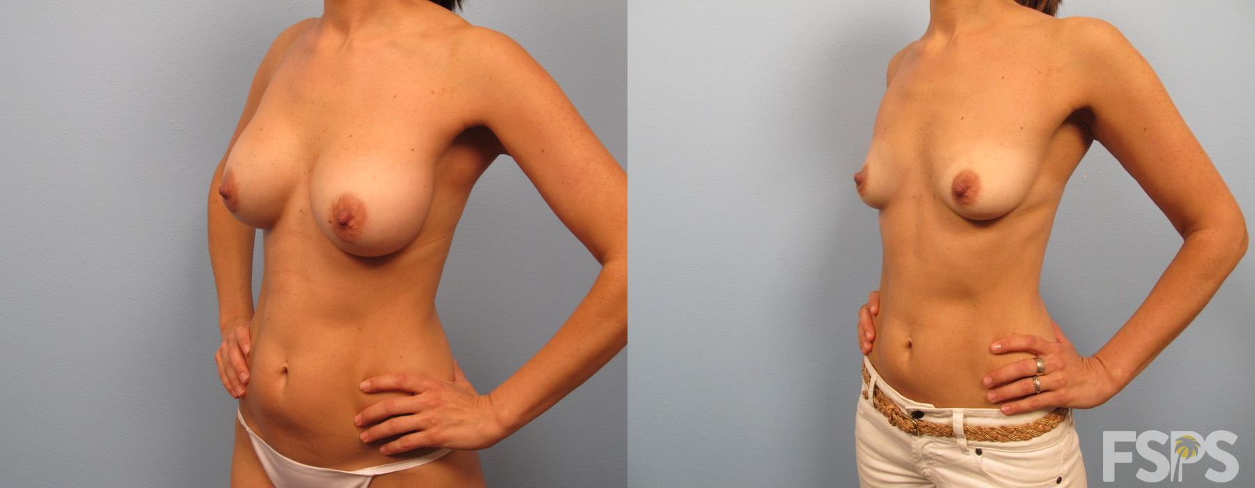 Before photo - Angle 3