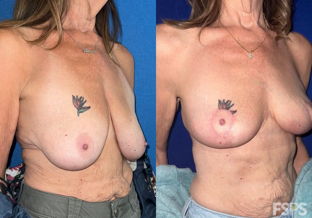 Before photo - Angle 2