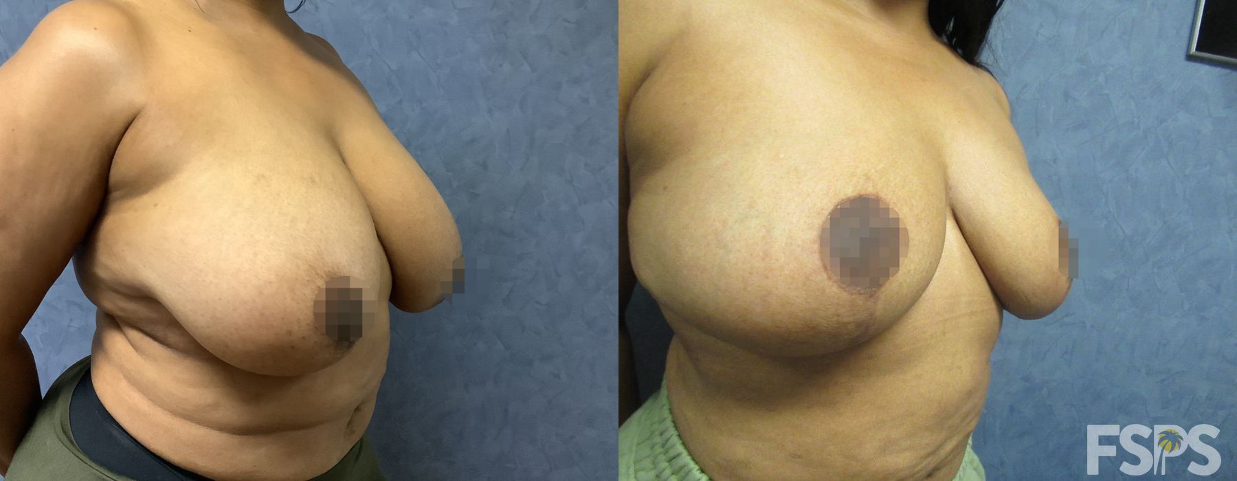 Before photo - Angle 3