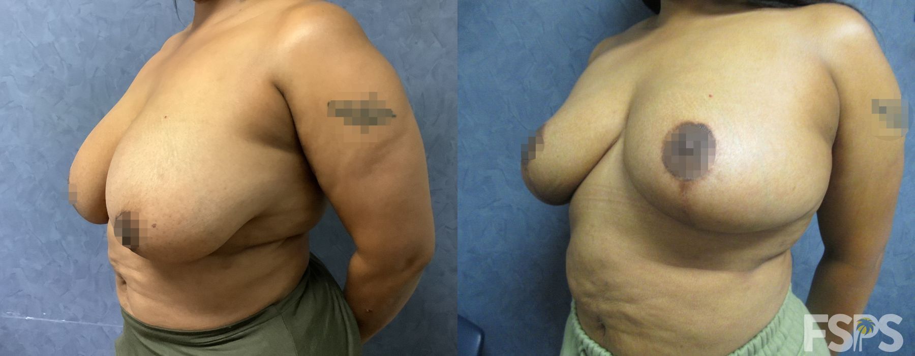 Before photo - Angle 2