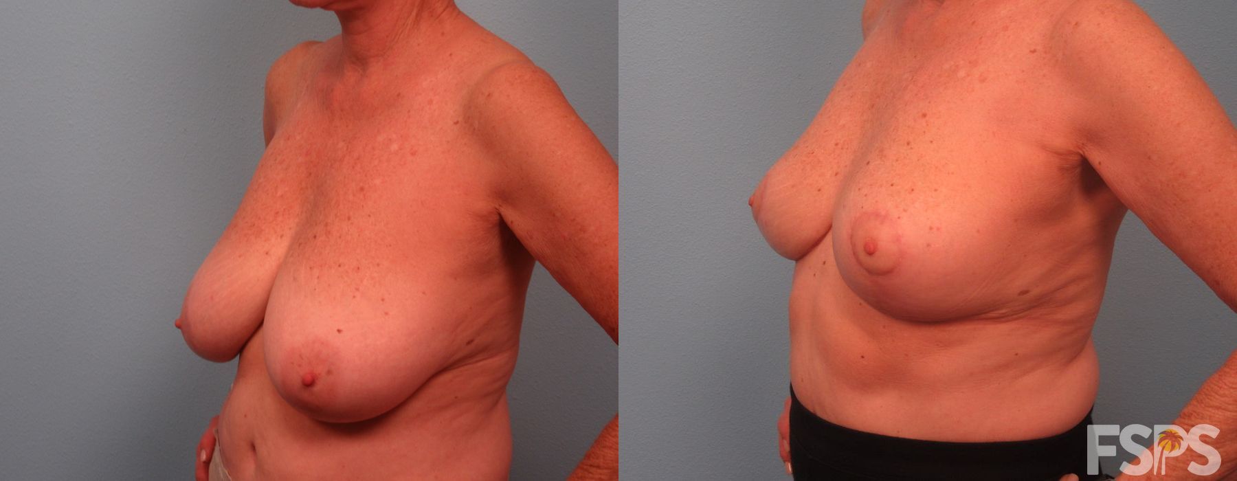 Before photo - Angle 2