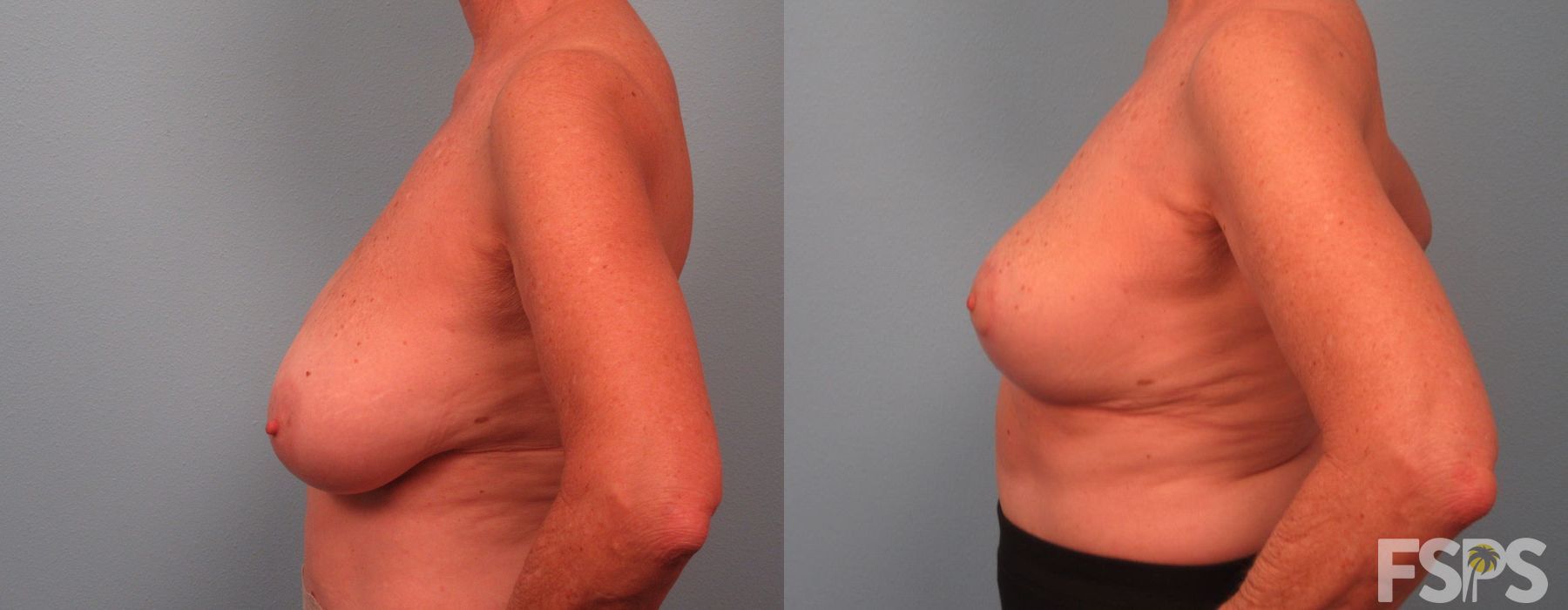 Before photo - Angle 3