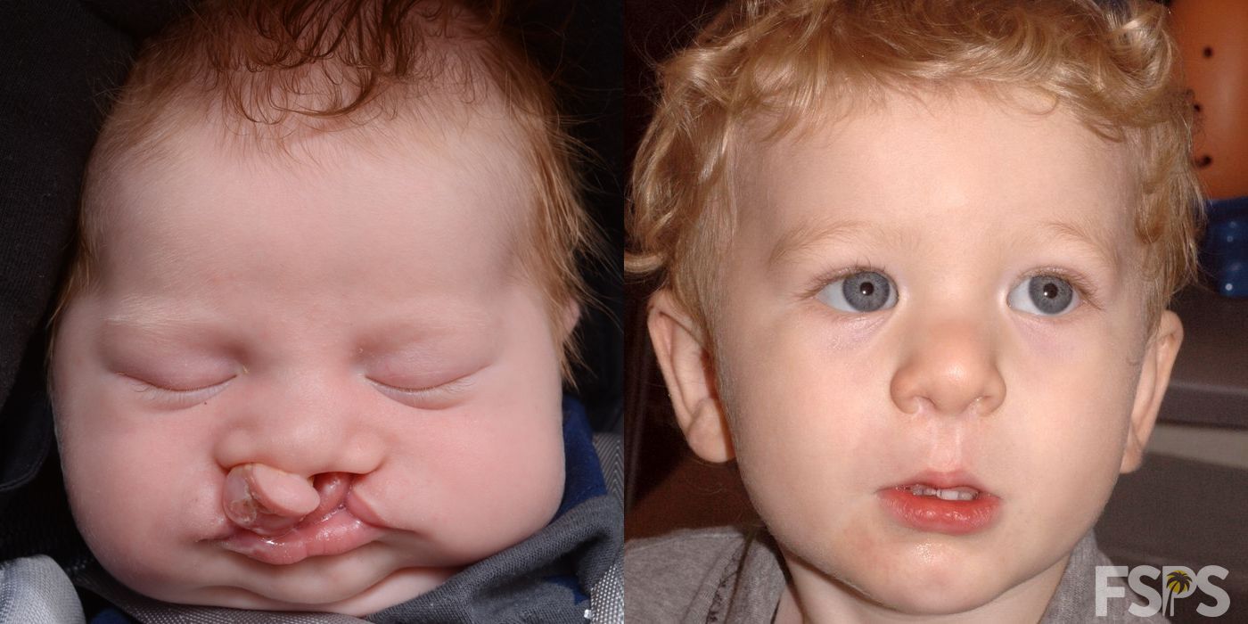 Before photo - Angle 2