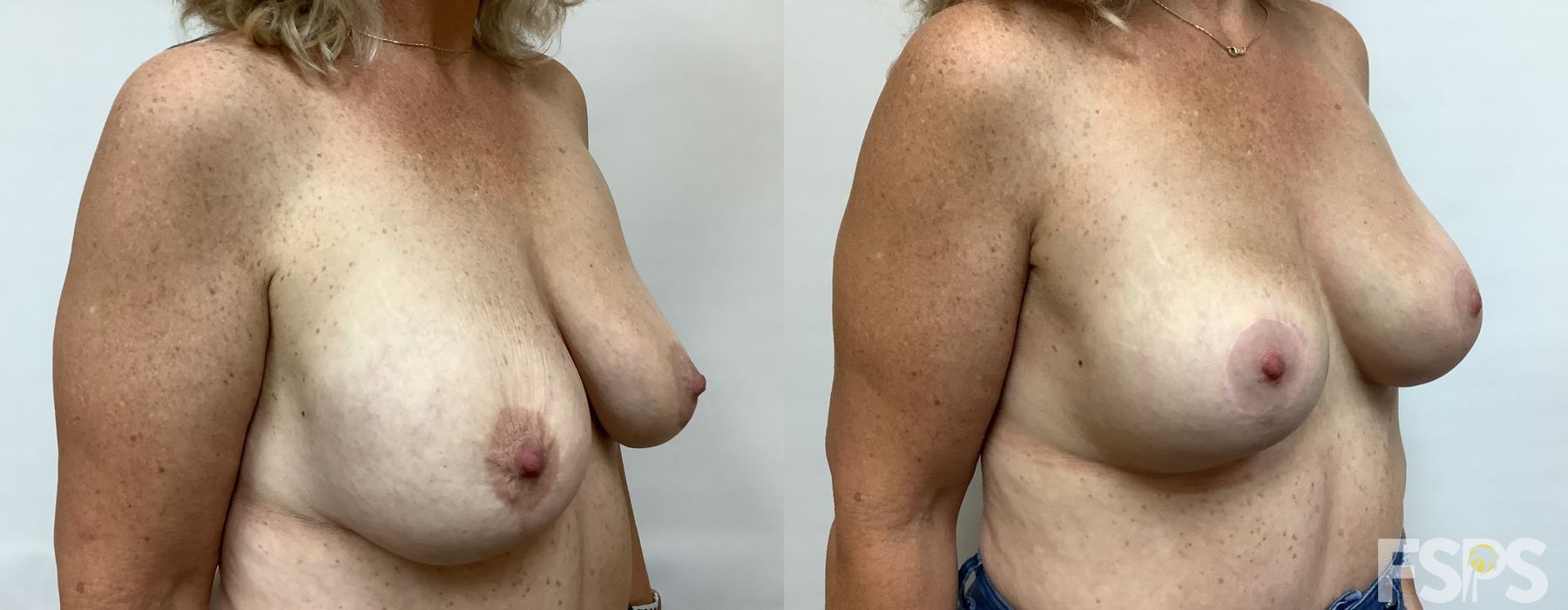 Before photo - Angle 4