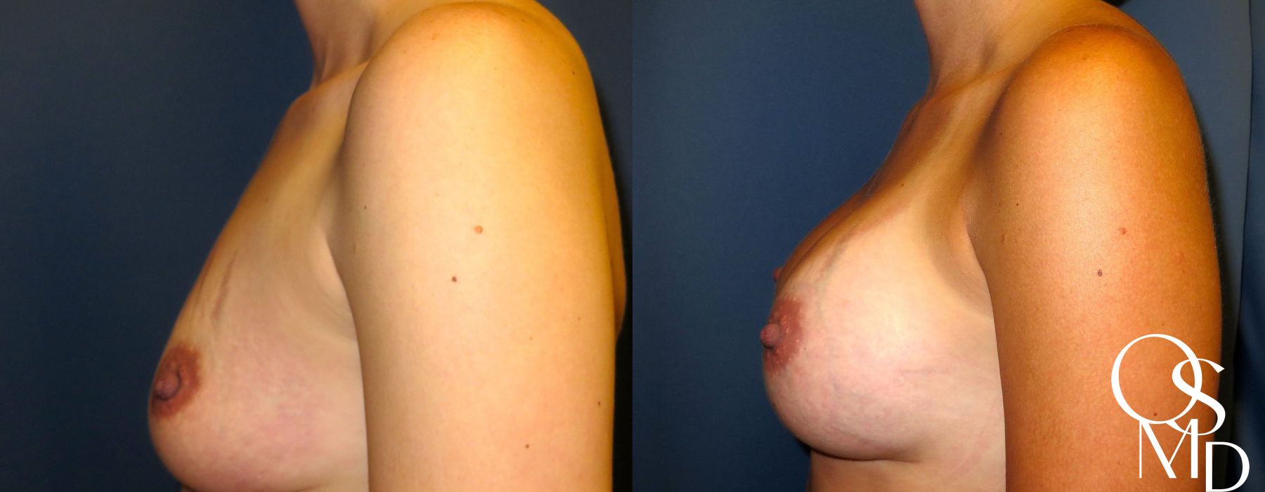 Before photo - Angle 2