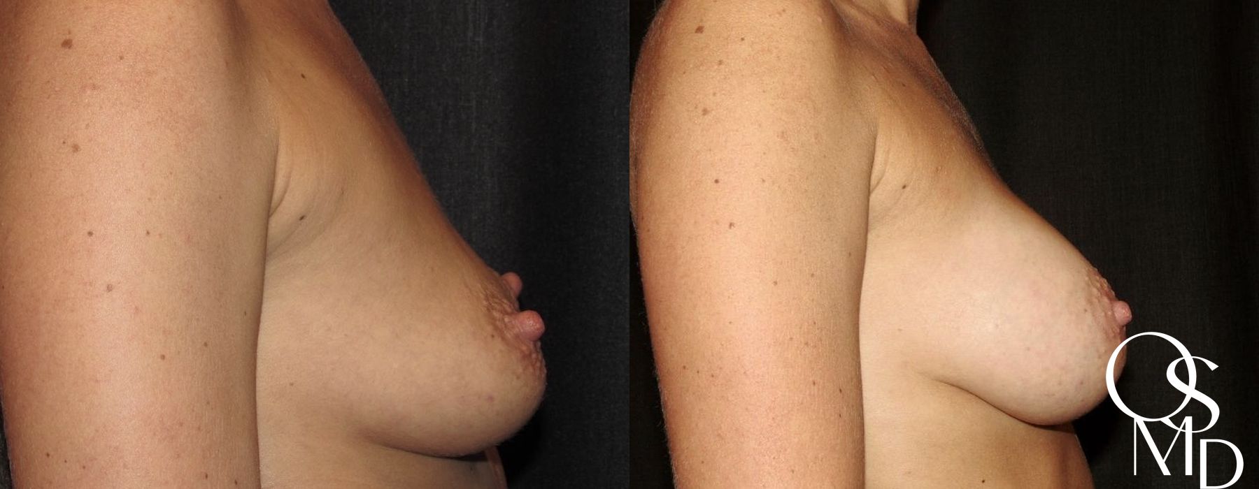 Before photo - Angle 2