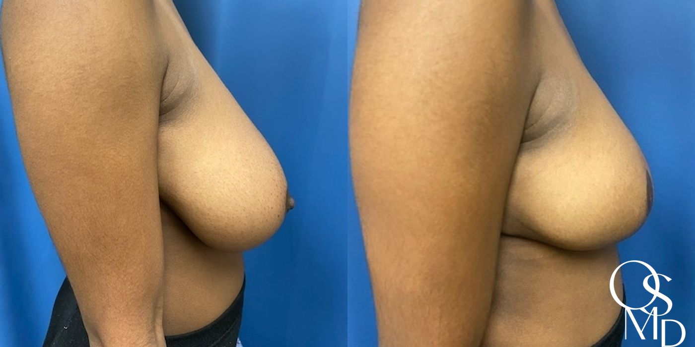 Before photo - Angle 2