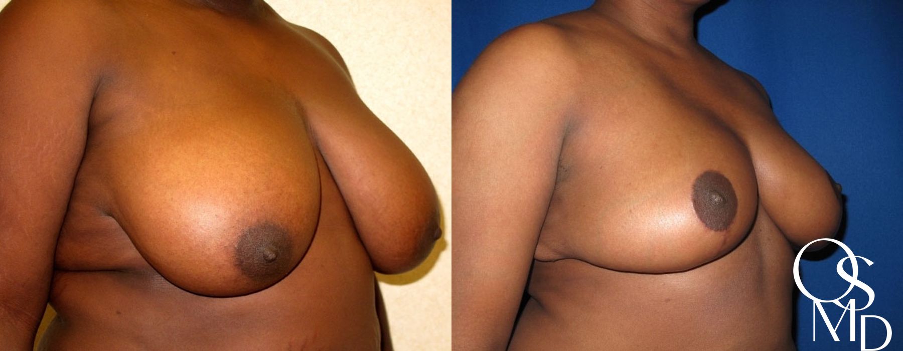 Before photo - Angle 2