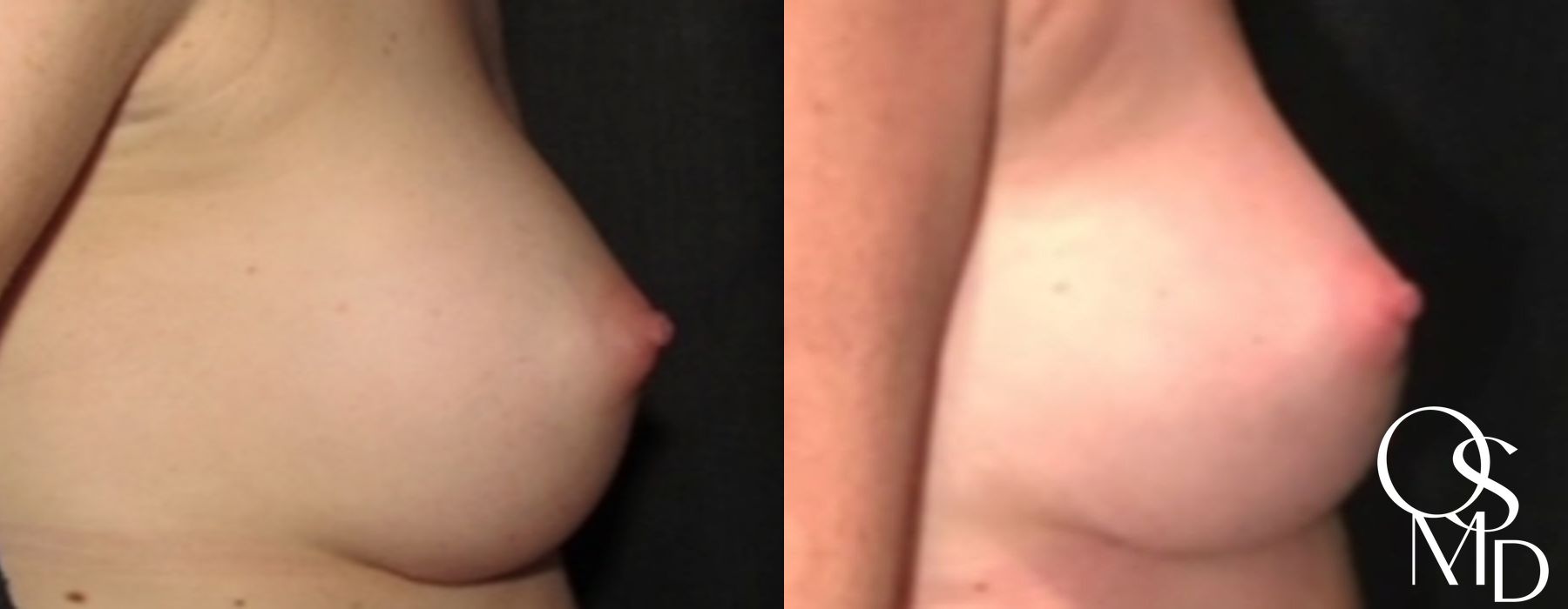 Before photo - Angle 3