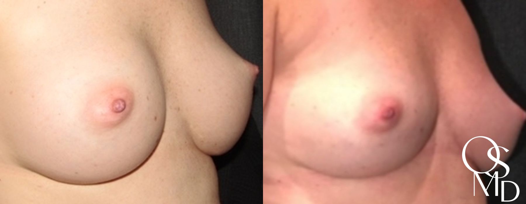 Before photo - Angle 2