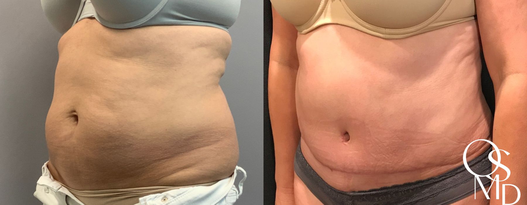 Before photo - Angle 4