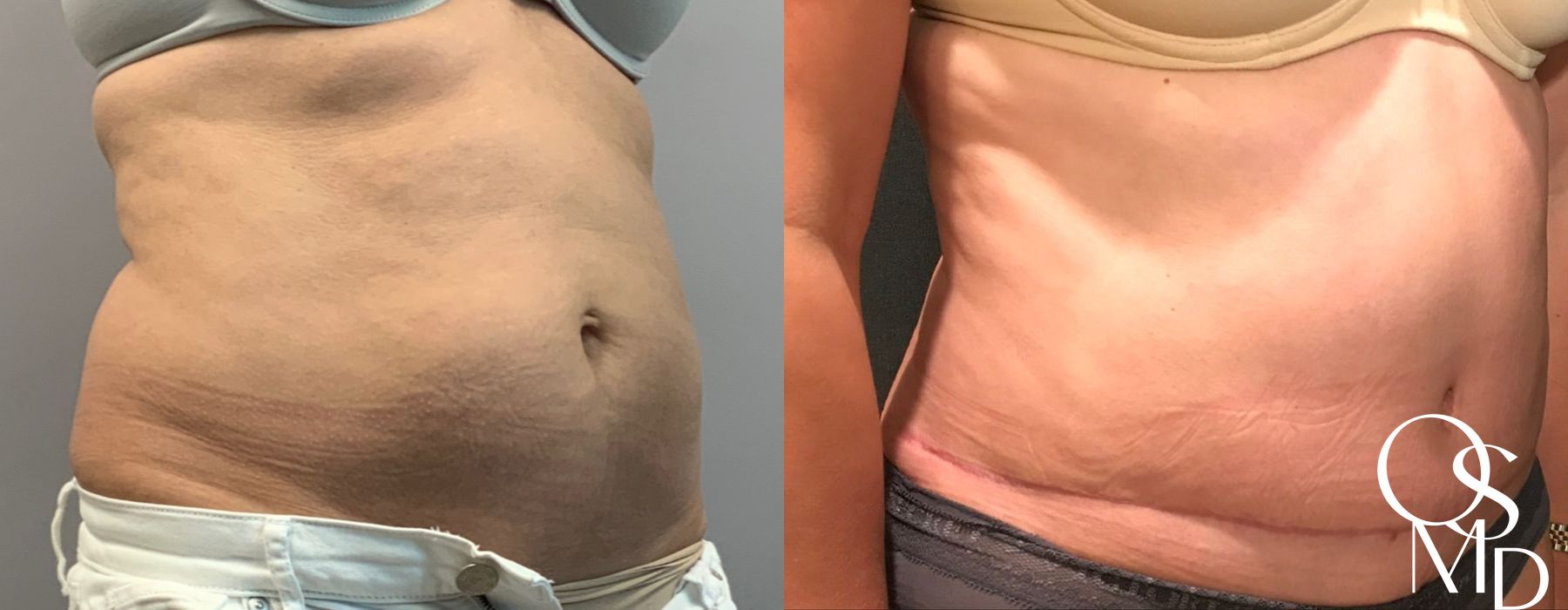 Before photo - Angle 5