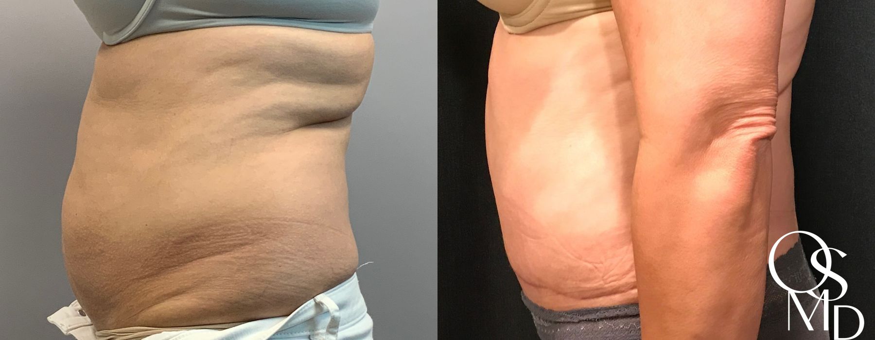 Before photo - Angle 2