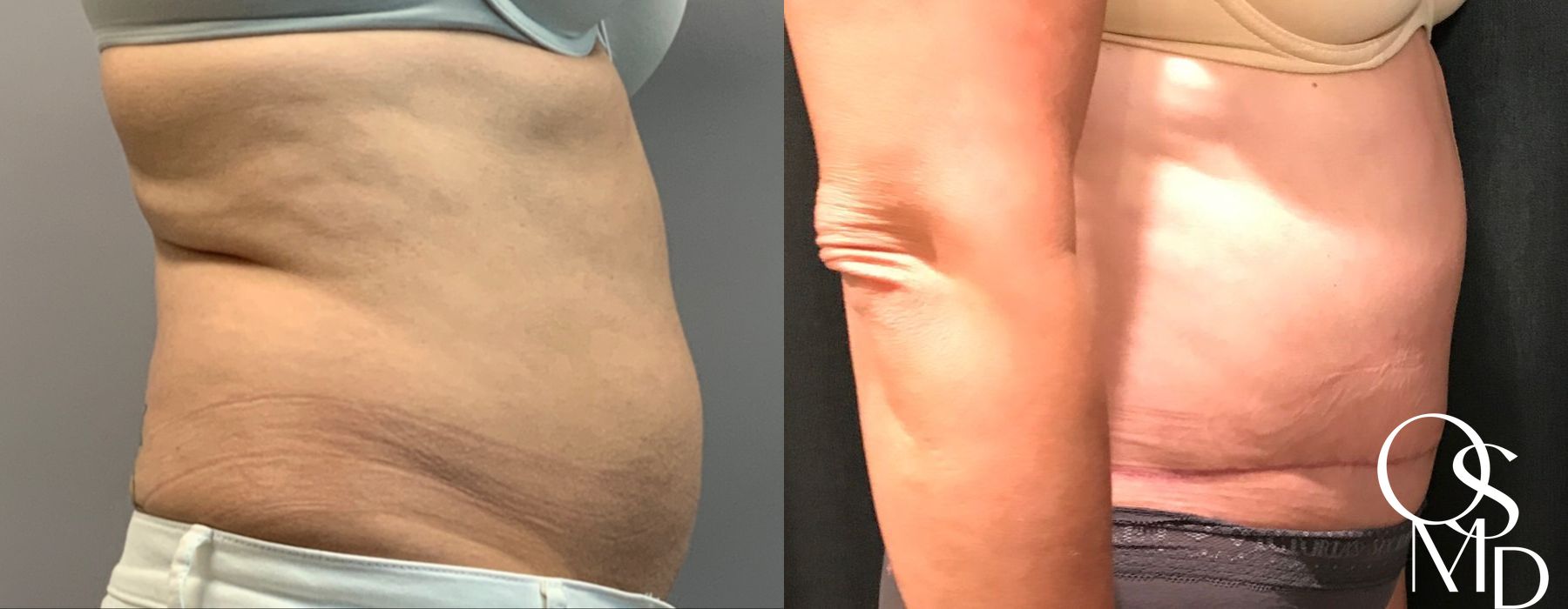 Before photo - Angle 3