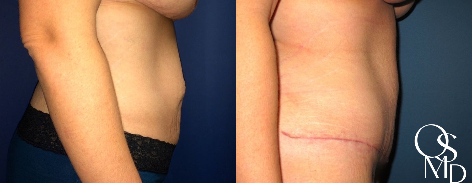 Before photo - Angle 2