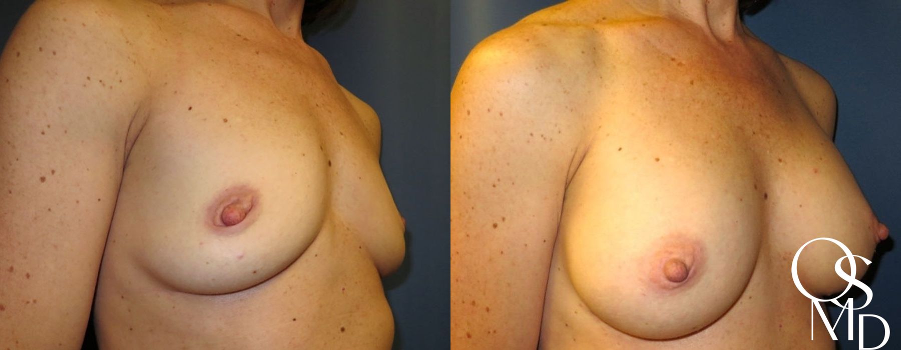 Before photo - Angle 2