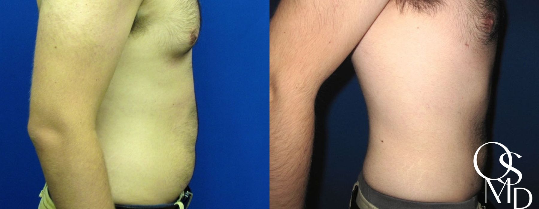 Before photo - Angle 3