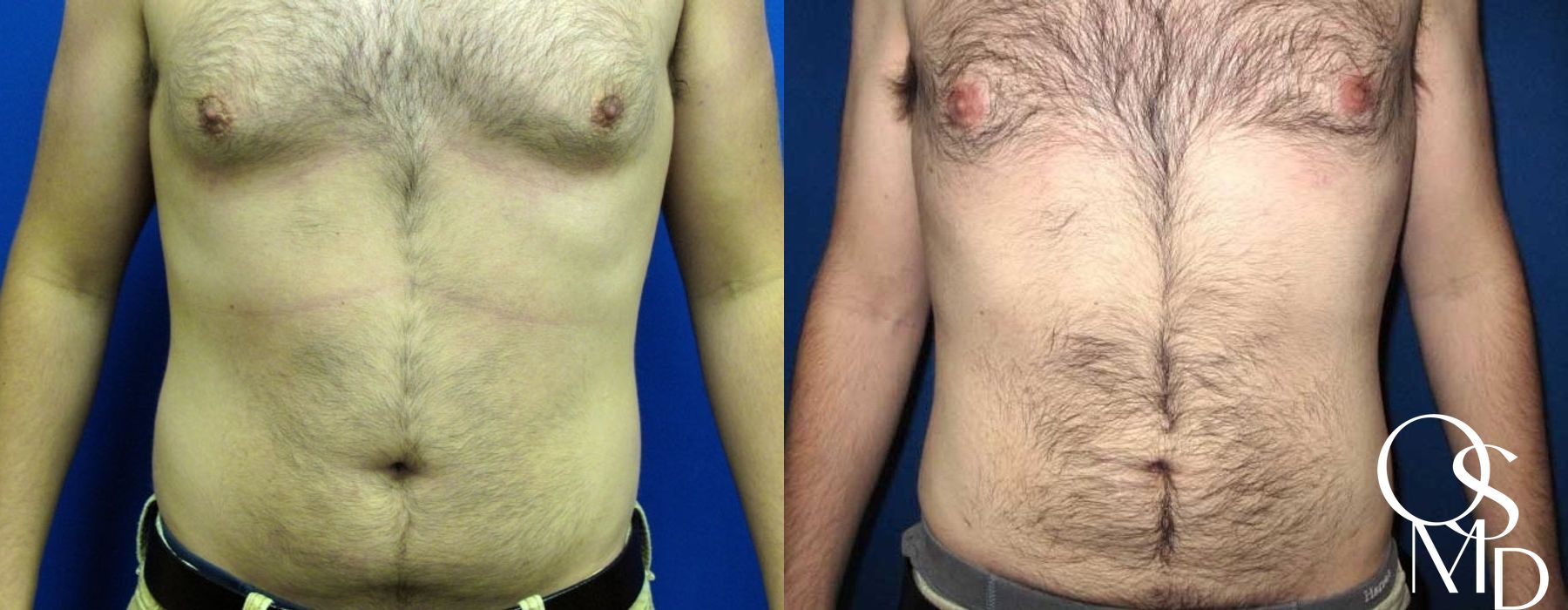 Before photo - Angle 2