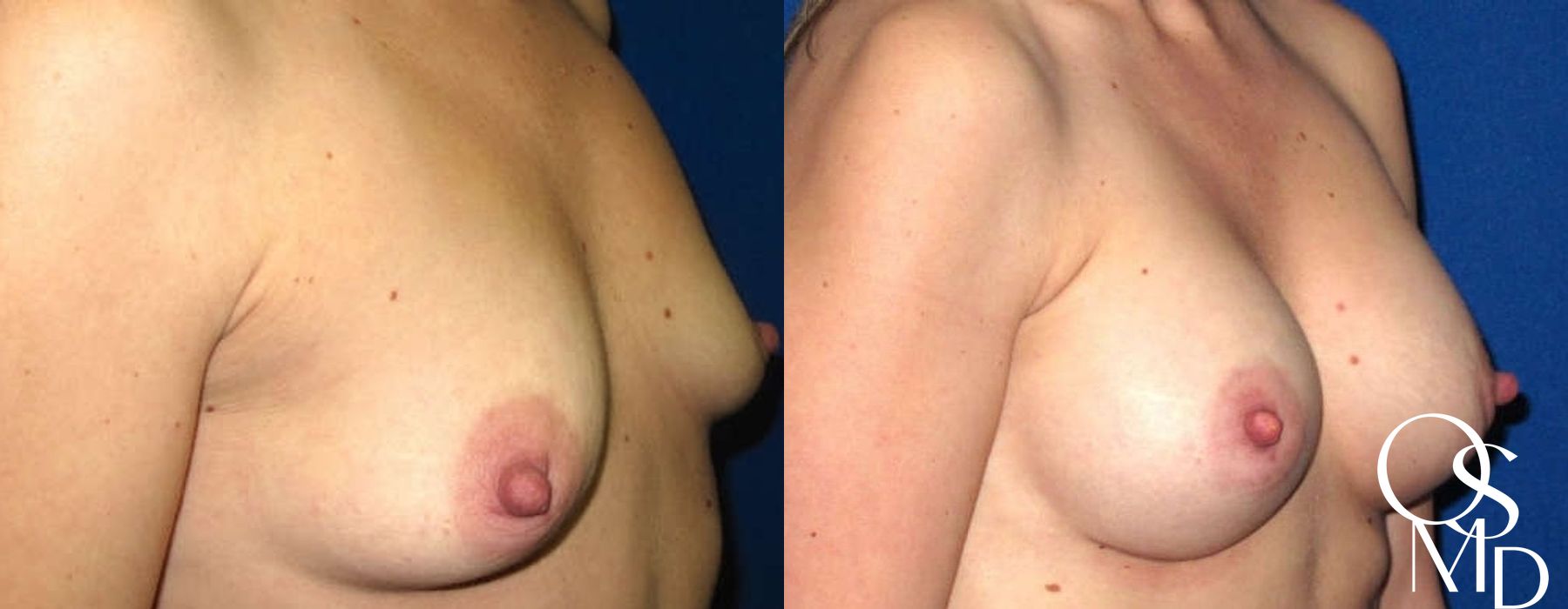 Before photo - Angle 2