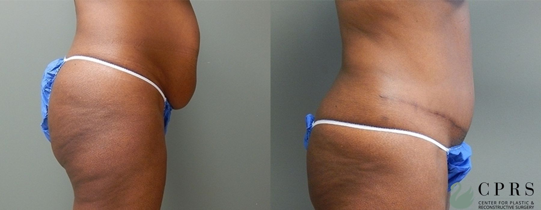 Before photo - Angle 2