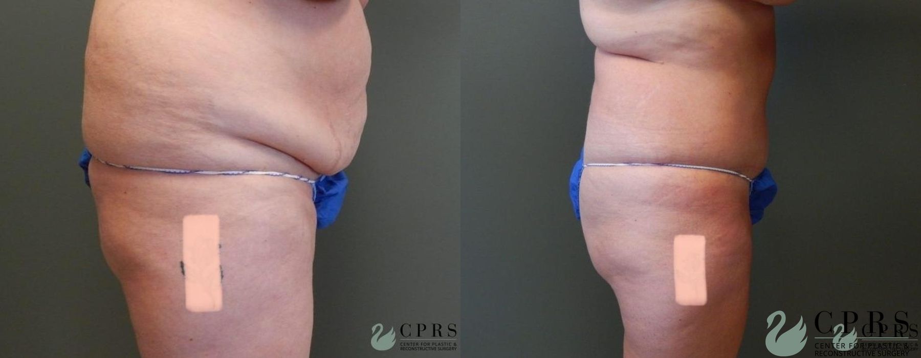 Before photo - Angle 2