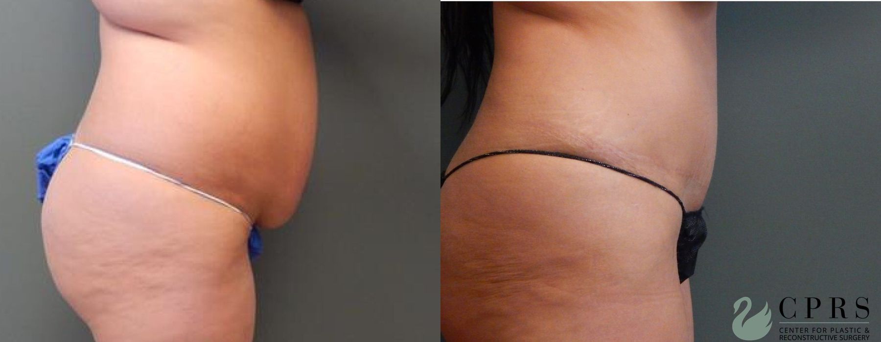 Before photo - Angle 3