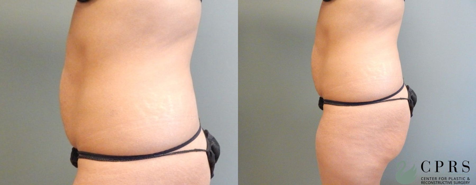 Before photo - Angle 2