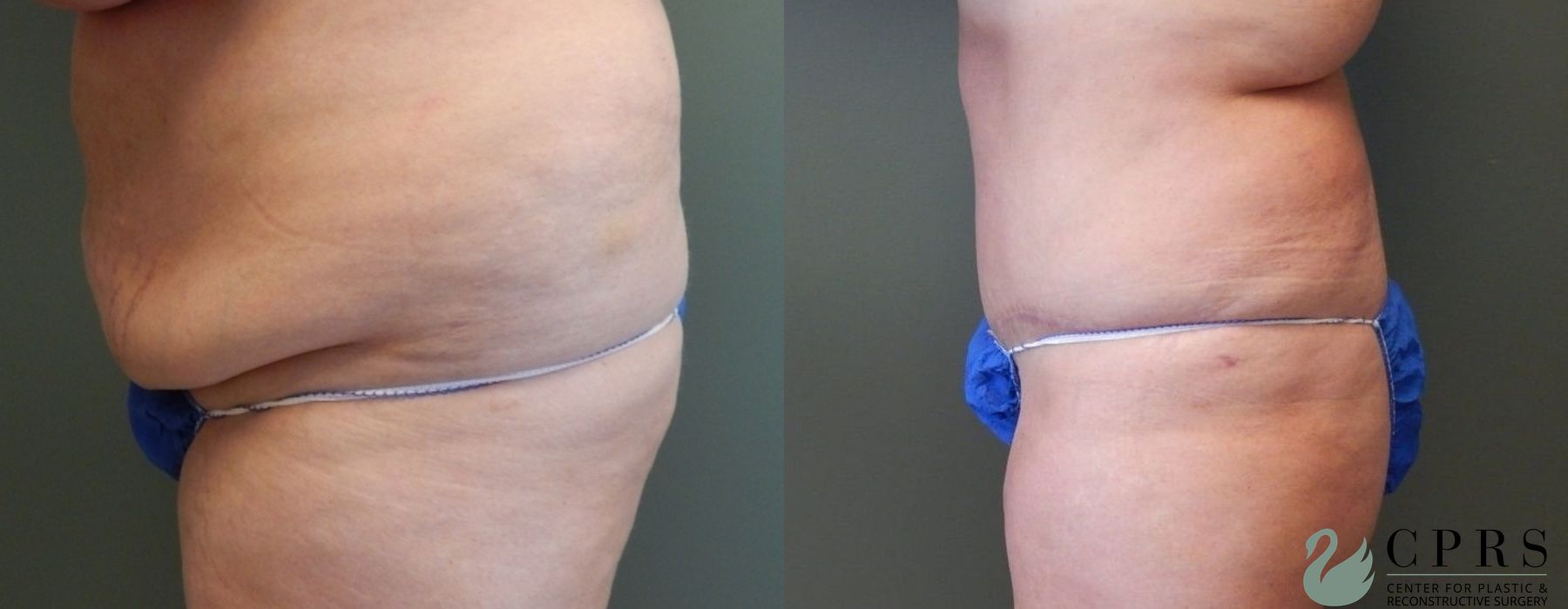 Before photo - Angle 3