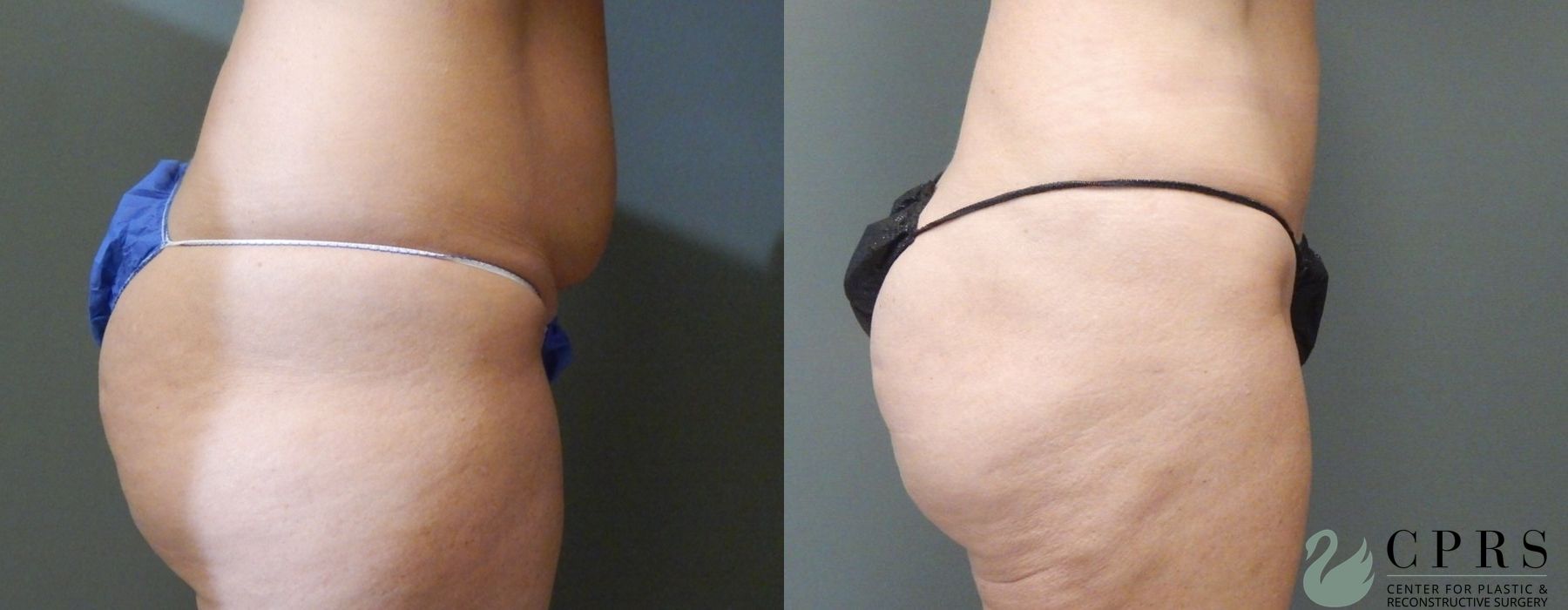 Before photo - Angle 2