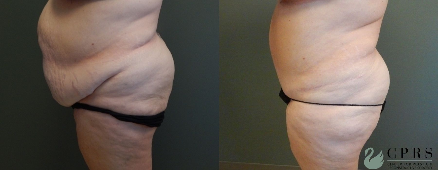 Before photo - Angle 3