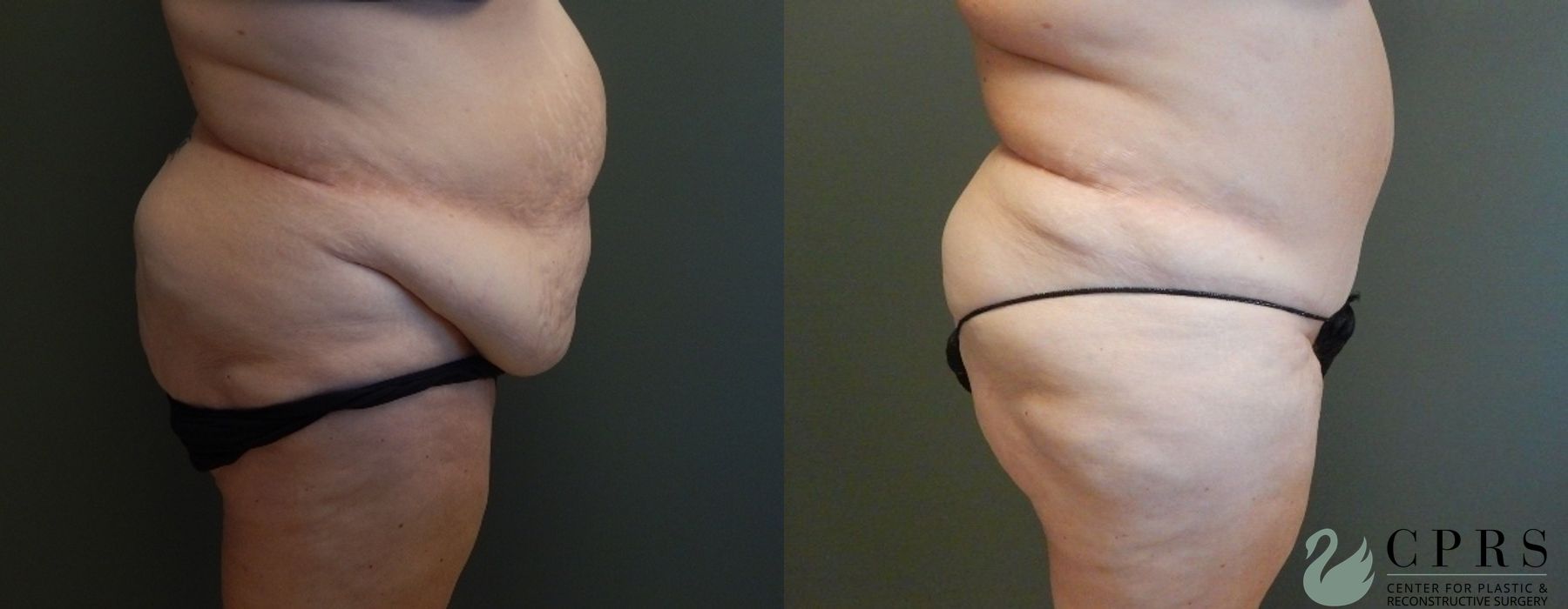 Before photo - Angle 2