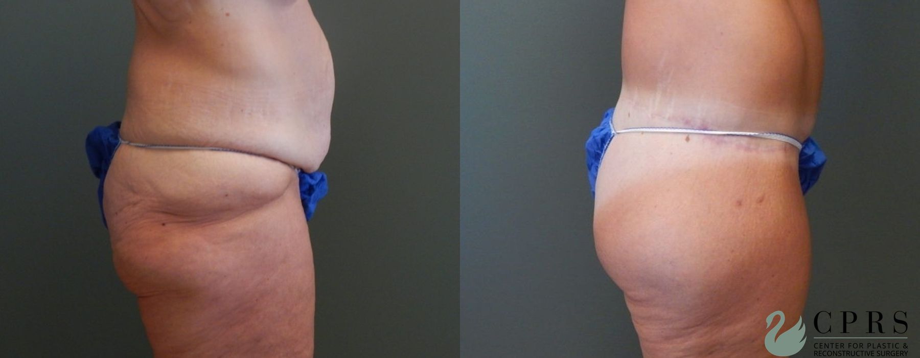 Before photo - Angle 3