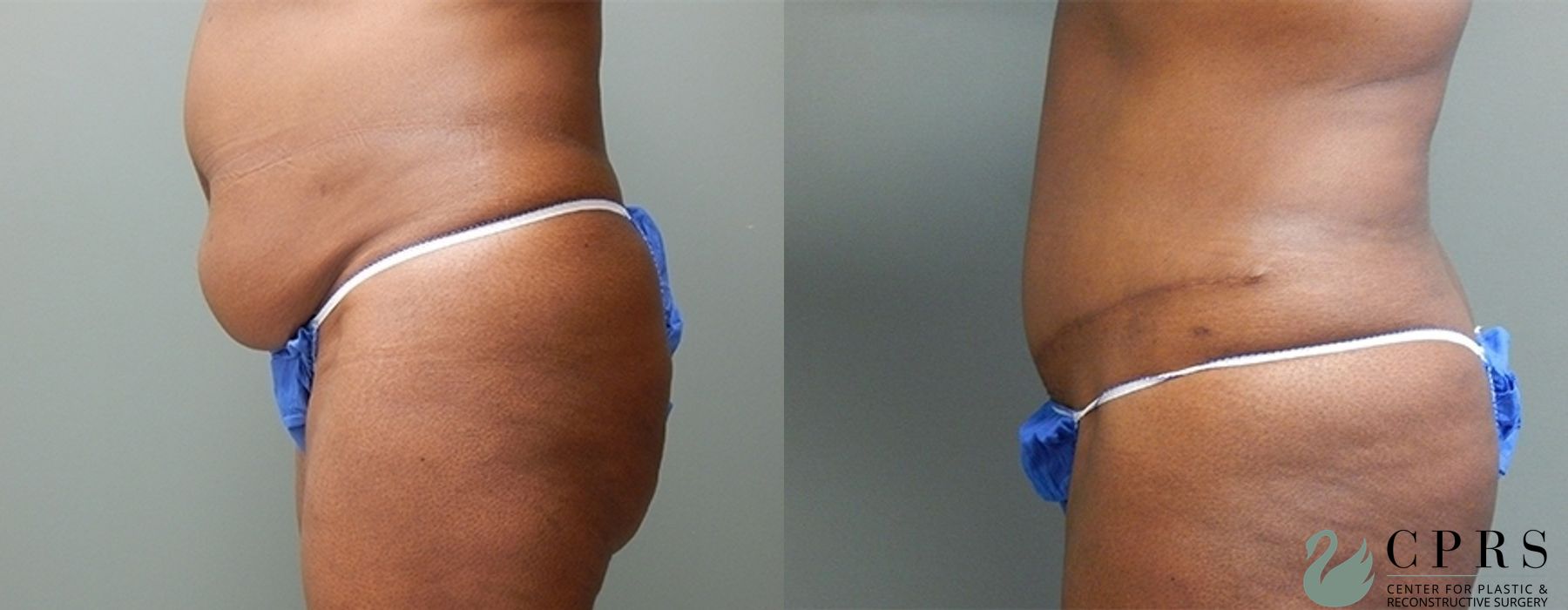 Before photo - Angle 3