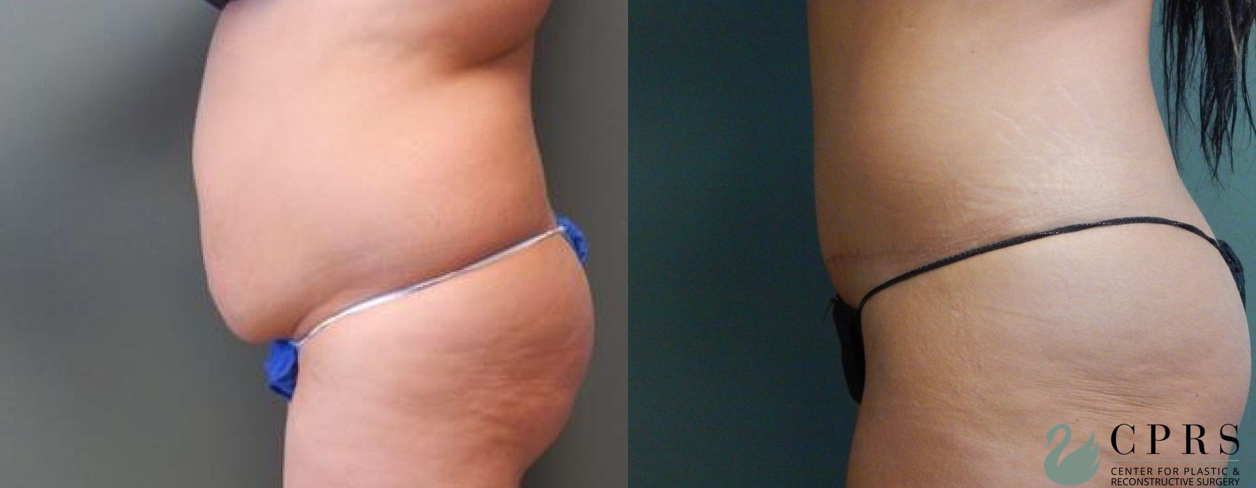 Before photo - Angle 2