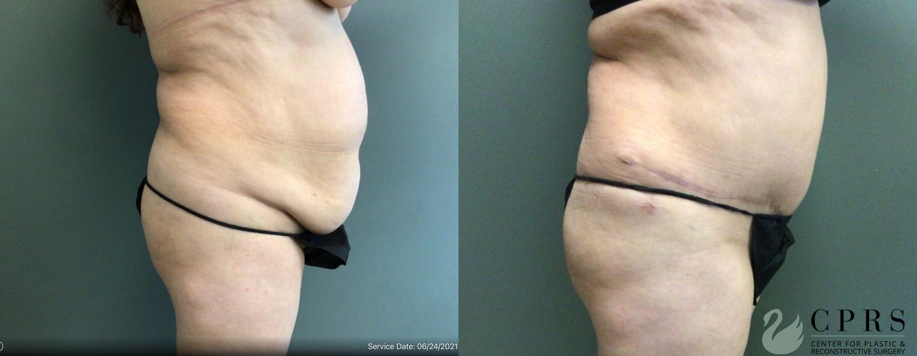 Before photo - Angle 3