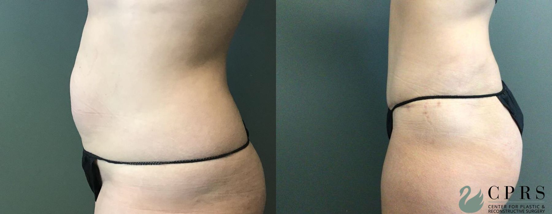 Before photo - Angle 2