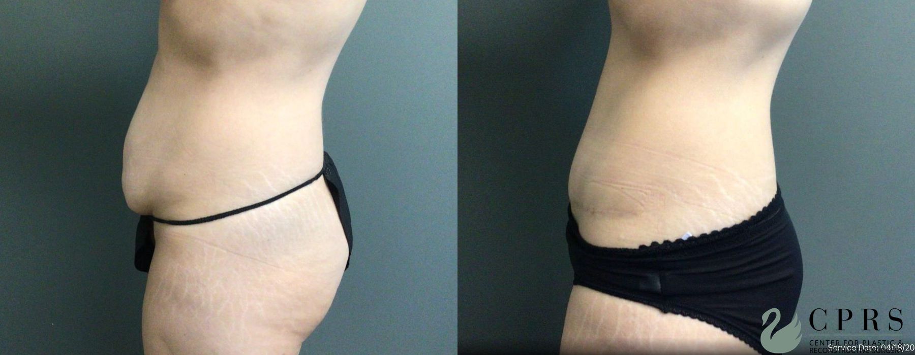 Before photo - Angle 3