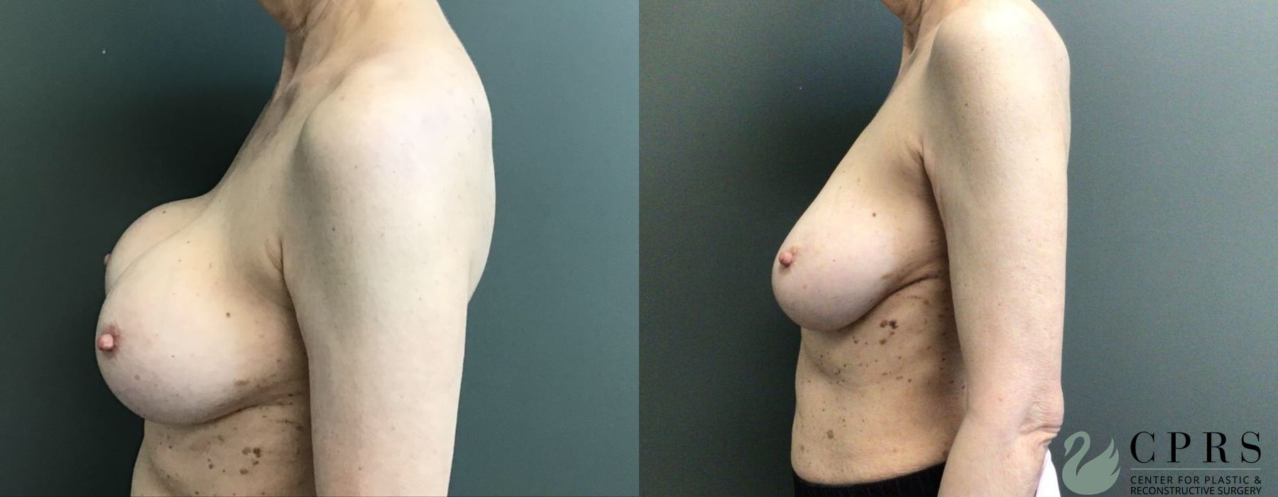 Before photo - Angle 3