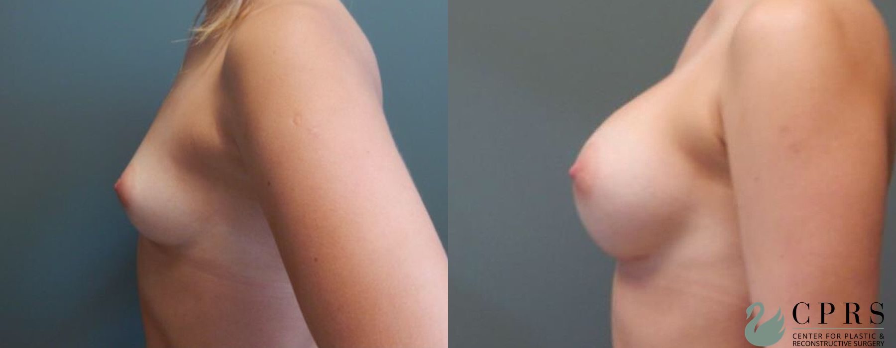 Before photo - Angle 2