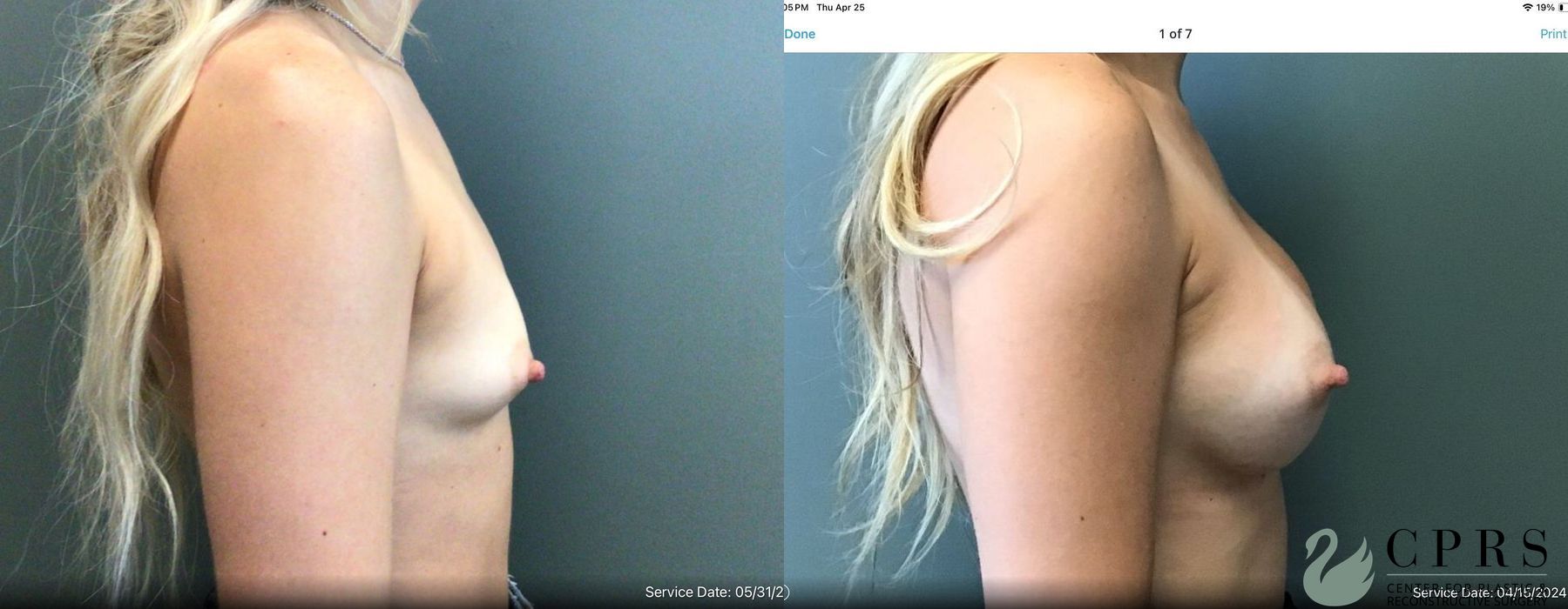 Before photo - Angle 2