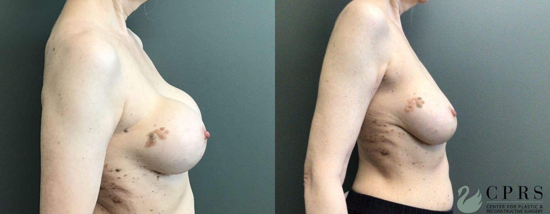 Before photo - Angle 2