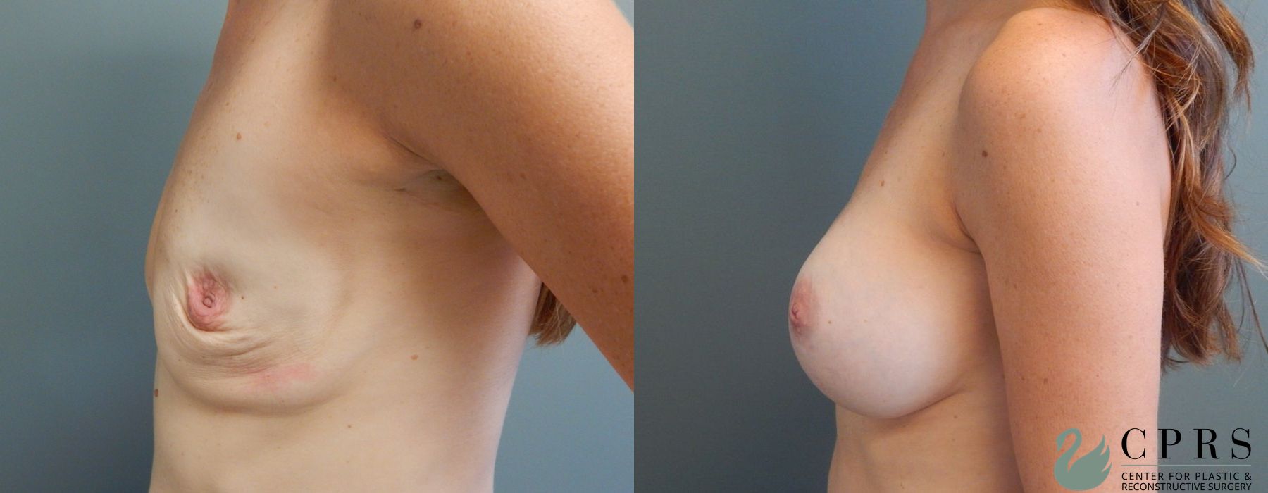 Before photo - Angle 3