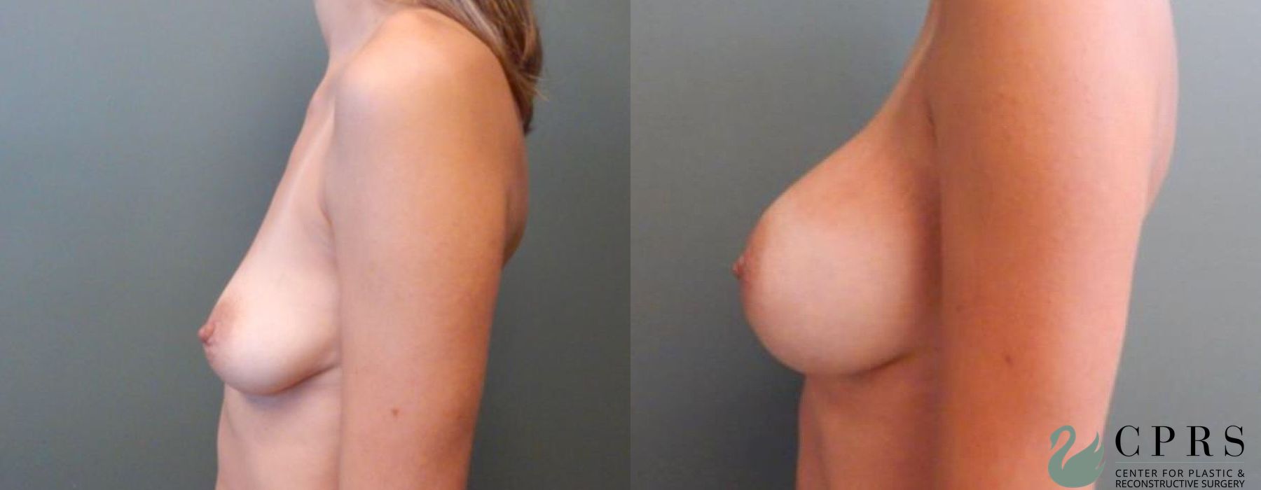 Before photo - Angle 2