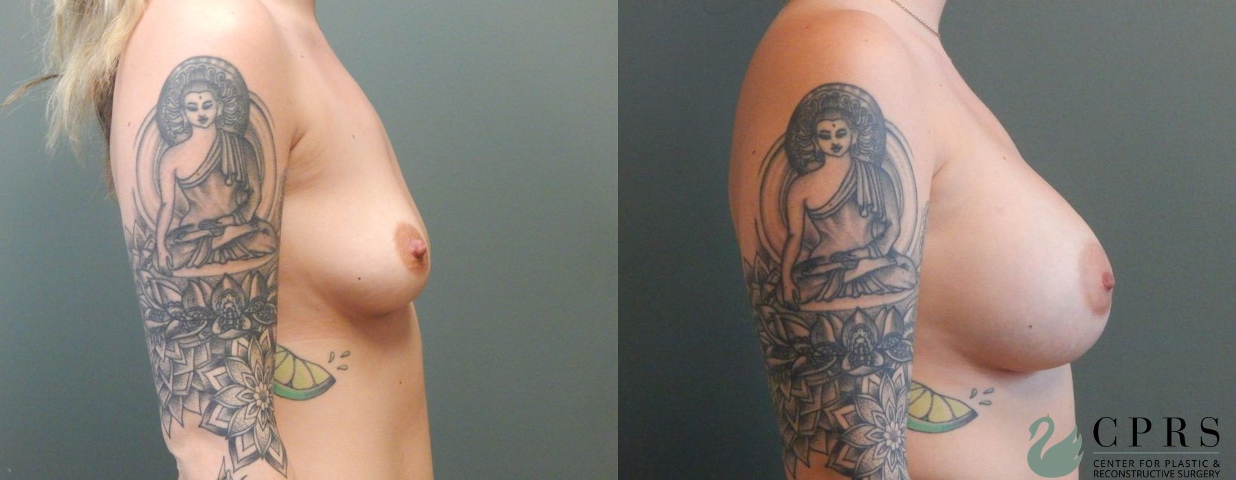 Before photo - Angle 2