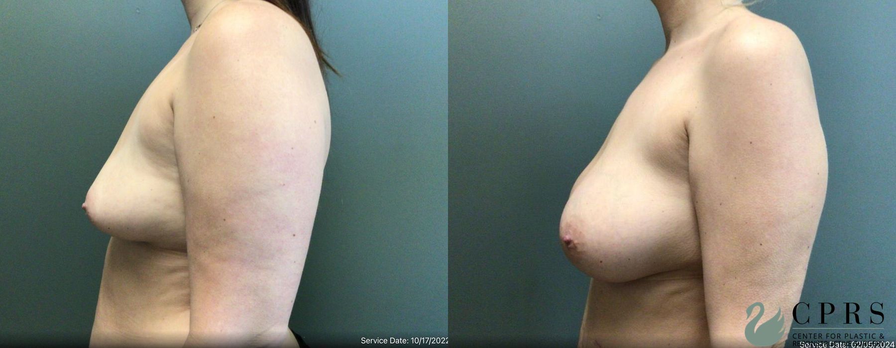 Before photo - Angle 2